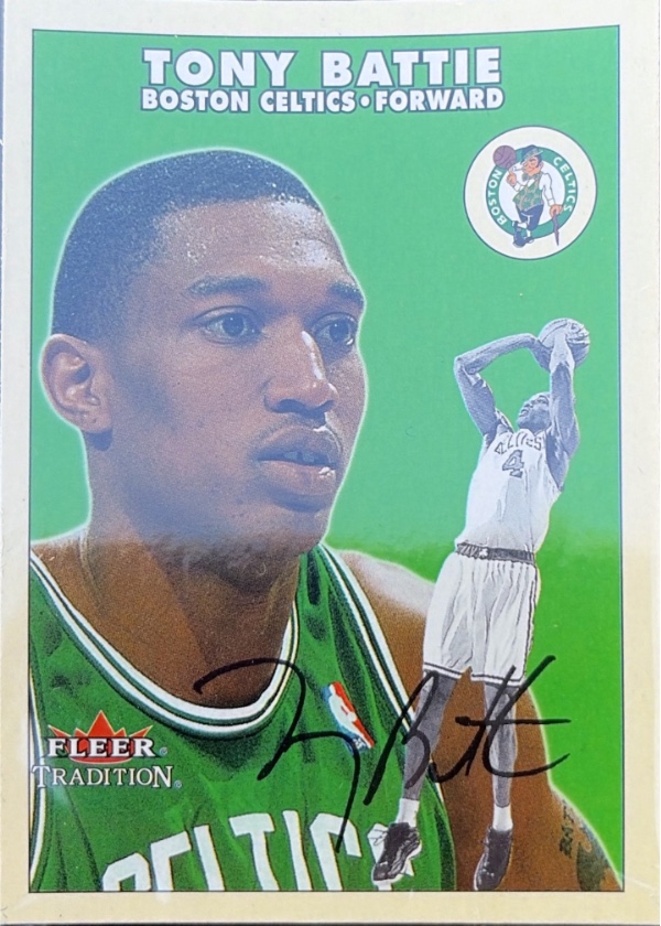 Tony Battie